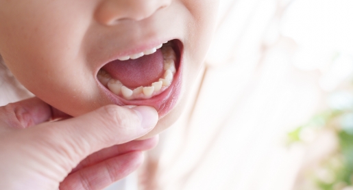 できる限り抜かない治療